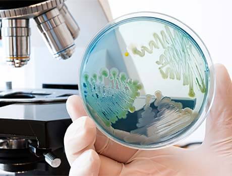 Bakterienkultur und Mikroskop